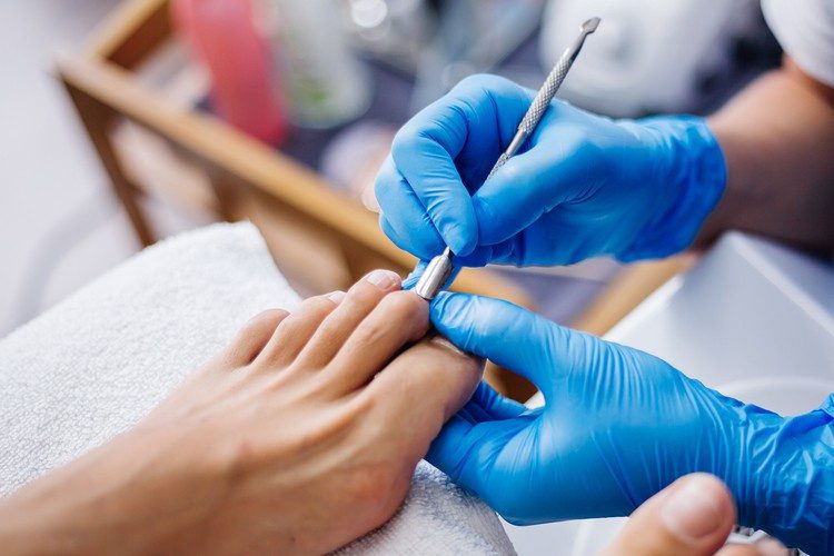 Nagelvårdsset för Inåtväxande Tånagel – 7 Delar i Rostfritt Stål med Förvaringsask - Bild 3